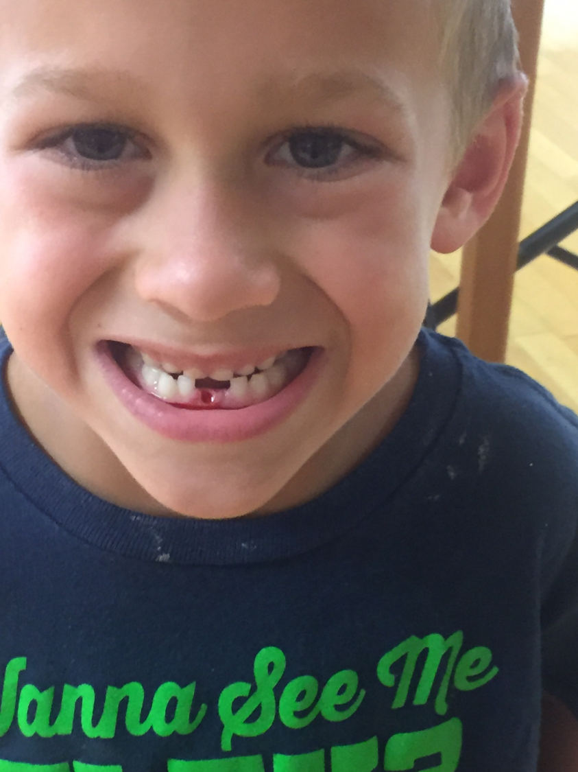 Wyatt lost his tooth @ camp!